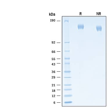 2 μg/lane of Recombinant SARS-CoV-2 B.1.640 Spike (GCN4-IZ) Histag Protein (Catalog # 11076-CV) was resolved with SDS-PAGE under reducing (R) and non-reducing (NR) conditions and visualized by Coomassie® Blue staining, showing bands at 149-165 kDa.