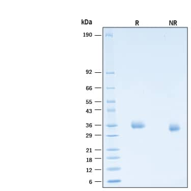 2 μg/lane of Recombinant SARS-CoV-2 B.1.640 Spike RBD His-tag Protein (Catalog # 11077-CV) was resolved with SDS-PAGE under reducing (R) and non-reducing (NR) conditions and visualized by Coomassie® Blue staining, showing bands at 33-39 kDa.