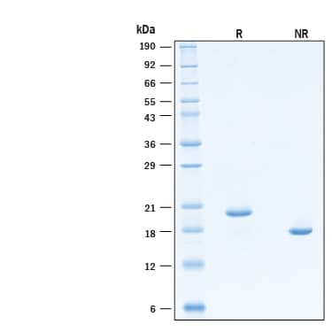 2 μg/lane of Recombinant Human IFN-alpha 7/IFNA7 Protein (Catalog # 11079-IF) was resolved with SDS-PAGE under reducing (R) and non-reducing (NR) conditions and visualized by Coomassie® Blue staining, showing bands at 18-22 kDa.
