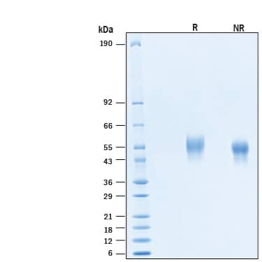 2 μg/lane of Recombinant Human IL1RAPL1 His-tag Protein (Catalog # 11080-MR) was resolved with SDS-PAGE under reducing (R) and non-reducing (NR) conditions and visualized by Coomassie® Blue staining, showing bands at 42-59 kDa.