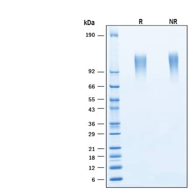 2 μg/lane of Recombinant Cynomolgus Monkey Mer His-tag Protein (Catalog # 11090-MR) was resolved with SDS-PAGE under reducing (R) and non-reducing (NR) conditions and visualized by Coomassie® Blue staining, showing bands at 110-120 kDa.