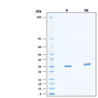 2 μg/lane of Recombinant Human c‑Abl His-tag Protein (Catalog # 11091-AL) was resolved with SDS-PAGE under reducing (R) and non-reducing (NR) conditions and visualized by Coomassie® Blue staining, showing bands at ~33-35 kDa.