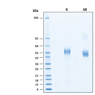 2 μg/lane of Recombinant Human CD19 His-tag Protein (Catalog # 11095-CD) was resolved with SDS-PAGE under reducing (R) and non-reducing (NR) conditions and visualized by Coomassie® Blue staining, showing bands at 50-65 kDa.