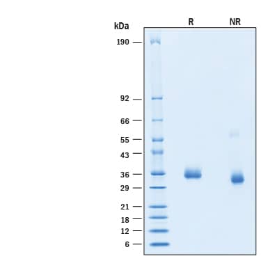 2 μg/lane of Recombinant SARS-CoV-2 B.1.640.2 Spike RBD His-tag Protein (Catalog # 11097-CV) was resolved with SDS-PAGE under reducing (R) and non-reducing (NR) conditions and visualized by Coomassie® Blue staining, showing bands at 33-37 kDa.