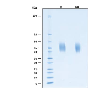 2 μg/lane of Recombinant SARS-CoV-2 B.1.1.529 Spike S1 NTD His-tag Protein (Catalog # 11104-CV) was resolved with SDS-PAGE under reducing (R) and non-reducing (NR) conditions and visualized by Coomassie® Blue staining, showing bands at 53-59 kDa.
