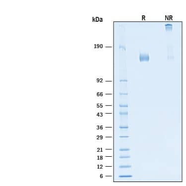 2 μg/lane of Recombinant SARS-CoV-2 B.1.640.2 Spike (GCN4-IZ) His-tag Protein (Catalog # 11105-CV) was resolved with SDS-PAGE under reducing (R) and non-reducing (NR) conditions and visualized by Coomassie® Blue staining, showing bands at 140-160 kD and 280-320 kDa, respectively.