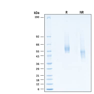 2 μg/lane of Recombinant Human TMEFF2/Tomoregulin‑2 His-tag Protein (Catalog # 11107-TF) was resolved with SDS-PAGE under reducing (R) and non-reducing (NR) conditions and visualized by Coomassie® Blue staining, showing bands at 55-66 kDa.