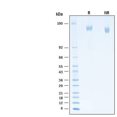 2 μg/lane of Recombinant SARS-CoV-2 P.2 Spike (GCN4-IZ) His-tag Protein (Catalog # 11108-CV) was resolved with SDS-PAGE under reducing (R) and non-reducing (NR) conditions and visualized by Coomassie® Blue staining, showing bands at 150-170 kDa.