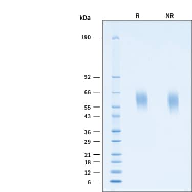 2 μg/lane of Recombinant SARS-CoV-2 P.1 Spike S1 NTD His-tag Protein (Catalog # 11111-CV) was resolved with SDS-PAGE under reducing (R) and non-reducing (NR) conditions and visualized by Coomassie® Blue staining, showing bands at 57-63 kDa.