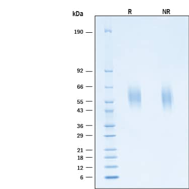 2 μg/lane of Recombinant SARS-CoV-2 Spike S1 NTD His-tag Protein (Catalog # 11112-CV) was resolved with SDS-PAGE under reducing (R) and non-reducing (NR) conditions and visualized by Coomassie® Blue staining, showing bands at 56-62 kDa.
