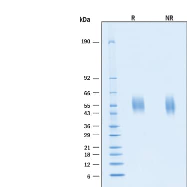 2 μg/lane of Recombinant SARS-CoV-2 B.1.617.2 Spike S1 NTD His-tag Protein (Catalog # 11114-CV) was resolved with SDS-PAGE under reducing (R) and non-reducing (NR) conditions and visualized by Coomassie® Blue staining, showing bands at 53-59 kDa.