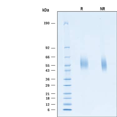 2 μg/lane of Recombinant SARS-CoV-2 B.1.1.7 Spike S1 NTD His-tag Protein (Catalog # 11115-CV) was resolved with SDS-PAGE under reducing (R) and non-reducing (NR) conditions and visualized by Coomassie® Blue staining, showing bands at 50-70 kDa.