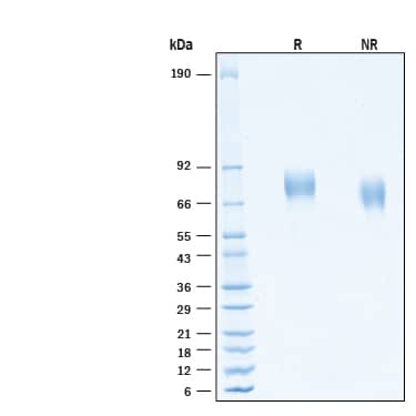 2 μg/lane of Recombinant Human FGFR1 alpha (IIIc) His-tag Protein (Catalog # 11118-FR) was resolved with SDS-PAGE under reducing (R) and non-reducing (NR) conditions and visualized by Coomassie® Blue staining, showing bands at 70-85 kDa.