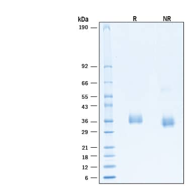 2 μg/lane of Recombinant SARS-CoV-2 BA.1.1 Spike RBD His-tag Protein (Catalog # 11131-CV) was resolved with SDS-PAGE under reducing (R) and non-reducing (NR) conditions and visualized by Coomassie® Blue staining, showing bands at 34-38 kDa.