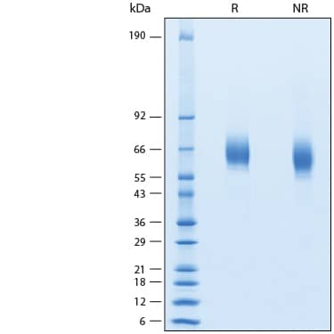 2 μg/lane of Recombinant Human FGFR3 alpha (IIIb) His-tag Protein (Catalog # 11136-FR) was resolved with SDS-PAGE under reducing (R) and non-reducing (NR) conditions and visualized by Coomassie® Blue staining, showing bands at 60-66 kDa.