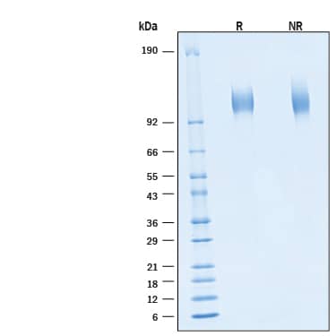 2 μg/lane of Recombinant SARS-CoV-2 B.1.1.7 Spike S1 Subunit His-tag Protein (Catalog # 11137-CV) was resolved with SDS-PAGE under reducing (R) and non-reducing (NR) conditions and visualized by Coomassie® Blue staining, showing bands at 106 - 123 kDa.