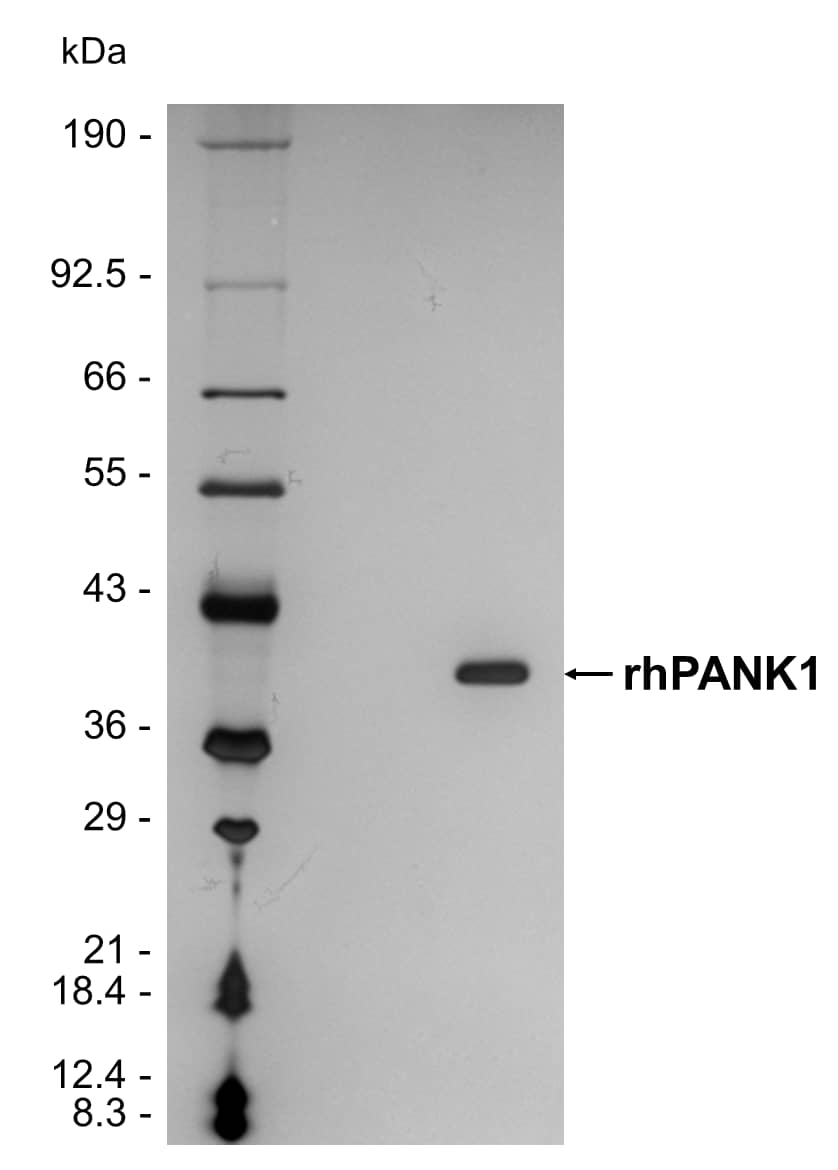 1 μg/lane of rhPANK1 (Catalog # 11161-PK) was resolved with SDS-PAGE under reducing (R) conditions and visualized by silver staining, showing a band at 40 kDa.