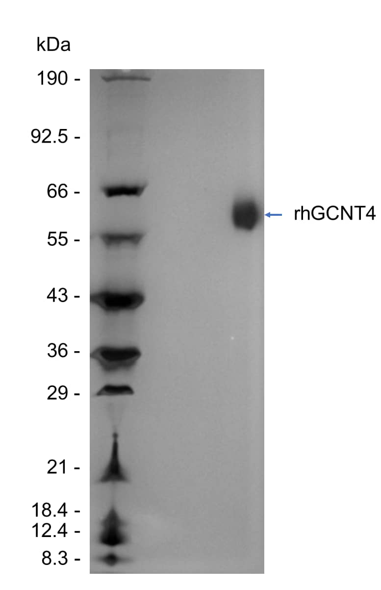 1 μg/lane of Recombinant Human GCNT4 His-tag (Catalog # 11162-GT ) was resolved with SDS-PAGE under reducing conditions and visualized by silver staining, showing a band at 50-66 kDa.