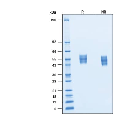 2 μg/lane of Recombinant Mouse IL1RAPL2 His-tag Protein (Catalog # 11164-MR) was resolved with SDS-PAGE under reducing (R) and non-reducing (NR) conditions and visualized by Coomassie® Blue staining, showing bands at 45-62 kDa.