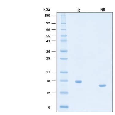 2 μg/lane of Recombinant Human IL‑10 Protein (Catalog # 11178-IL) was resolved with SDS-PAGE under reducing (R) and non-reducing (NR) conditions and visualized by Coomassie® Blue staining, showing bands at 17-19 kDa.