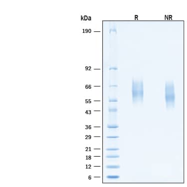 2 μg/lane of Recombinant Human IL‑18 R alpha /IL‑1 R5 His-tag Protein (Catalog # 11179-LR) was resolved with SDS-PAGE under reducing (R) and non-reducing (NR) conditions and visualized by Coomassie® Blue staining, showing bands at 57-68- kDa.