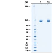 2 μg/lane of Recombinant Human alpha-L-Iduronidase/IDUA His-tag Protein (Catalog # 11180-GH) was resolved with SDS-PAGE under reducing (R) and non-reducing (NR) conditions and visualized by Coomassie® Blue staining, showing bands at 80-88 kDa.