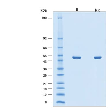 2 μg/lane of Recombinant SARS-CoV-2 BA.2 Nucleocapsid His-tag Protein (Catalog # 11182-CV) was resolved with SDS-PAGE under reducing (R) and non-reducing (NR) conditions and visualized by Coomassie® Blue staining, showing bands at 45-55 kDa.