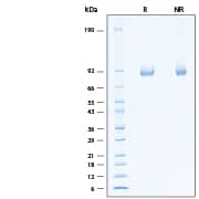 2 μg/lane of Recombinant Human alpha-L-Iduronidase/IDUA His-tag Protein (Catalog # 11201-GH) was resolved with SDS-PAGE under reducing (R) and non-reducing (NR) conditions and visualized by Coomassie® Blue staining, showing bands at 80-91 kDa.