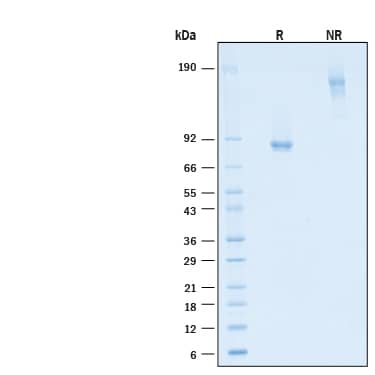 2 μg/lane of Recombinant Mouse TMEFF2/Tomoregulin‑2 Fc Chimera Protein (Catalog # 11204-TF) was resolved with SDS-PAGE under reducing (R) and non-reducing (NR) conditions and visualized by Coomassie® Blue staining, showing bands at 77-90 kDa and 150-180 kDa, respectively.