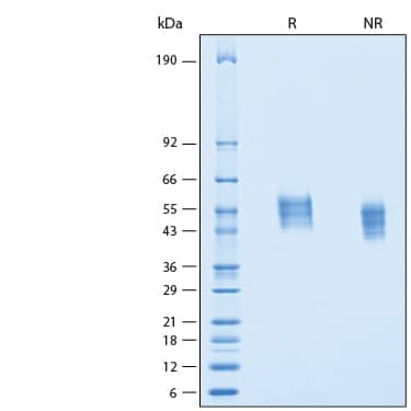 2 μg/lane of Recombinant Human IL1RAPL2 His-tag Protein (Catalog # 11207-MR) was resolved with SDS-PAGE under reducing (R) and non-reducing (NR) conditions and visualized by Coomassie® Blue staining, showing bands at 40-60 kDa.