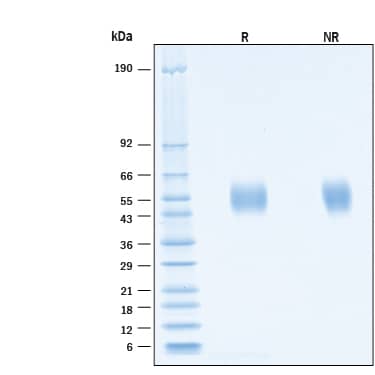2 μg/lane of Recombinant SARS-CoV-2 XD Spike S1 Subunit NTD His-tag Protein (Catalog # 11208-CV) was resolved with SDS-PAGE under reducing (R) and non-reducing (NR) conditions and visualized by Coomassie® Blue staining, showing bands at 53-59 kDa.