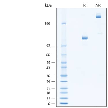 2 μg/lane of Recombinant Mouse Tie-1 (1-749) Fc Chimera Protein (Catalog # 11220-TI) was resolved with SDS-PAGE under reducing (R) and non-reducing (NR) conditions and visualized by Coomassie® Blue staining, showing bands at 105-125 kDa and 210-250 kDa, respectively.