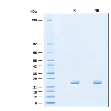 2 μg/lane of Recombinant Human PLUNC BPIFA1 His-tag Protein (Catalog # 11221-BF) was resolved with SDS-PAGE under reducing (R) and non-reducing (NR) conditions and visualized by Coomassie® Blue staining, showing bands at 21-28 kDa.