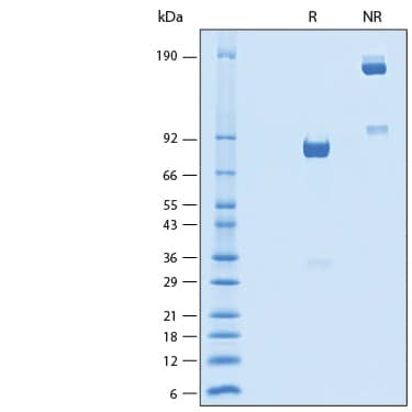 2 μg/lane of Recombinant Mouse IL1RAPL2 Fc Chimera Protein (Catalog # 11222-MR) was resolved with SDS-PAGE under reducing (R) and non-reducing (NR) conditions and visualized by Coomassie® Blue staining, showing bands at 75-88 kDa.