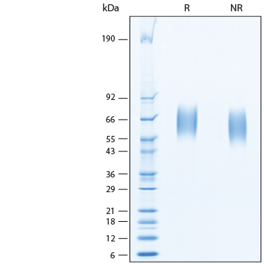 2 μg/lane of Recombinant Human IL-17RA/IL-17R His-tag Protein (Catalog # 11234-IR) was resolved with SDS-PAGE under reducing (R) and non-reducing (NR) conditions and visualized by Coomassie® Blue staining, showing bands at 60-68 kDa.