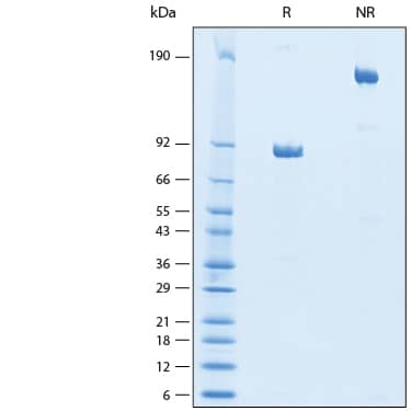 2 μg/lane of Recombinant Human CD177 Fc Chimera Protein (Catalog # 11238-CD) was resolved with SDS-PAGE under reducing (R) and non-reducing (NR) conditions and visualized by Coomassie® Blue staining, showing bands at 83-93 kDa and 160-180 kDa, respectively.