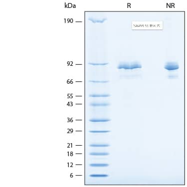 2 μg/lane of Recombinant Rat Periostin/OSF-2 (C62A) His-tag Protein (Catalog # 11253-F2) was resolved with SDS-PAGE under reducing (R) and non-reducing (NR) conditions and visualized by Coomassie® Blue staining, showing bands at 67-92 kDa.