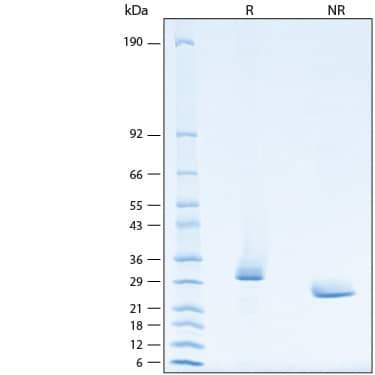 2 μg/lane of Recombinant Rhesus VSIG8 His-tag Protein (Catalog # 11256-VS) was resolved with SDS-PAGE under reducing (R) and non-reducing (NR) conditions and visualized by Coomassie® Blue staining, showing bands at 28-38 kDa.