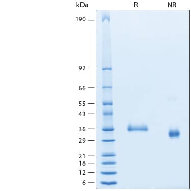 2 μg/lane of Recombinant SARS-CoV-2 BA.2.75 Spike RBD His-tag Protein (Catalog # 11259-CV) was resolved with SDS-PAGE under reducing (R) and non-reducing (NR) conditions and visualized by Coomassie® Blue staining, showing bands at 33-39 kDa.