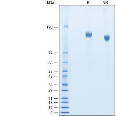 2 μg/lane of Recombinant SARS-CoV-2 BA.2.75 S (GCN4-IZ) His-tag Protein (Catalog # 11260-CV) was resolved with SDS-PAGE under reducing (R) and non-reducing (NR) conditions and visualized by Coomassie® Blue staining, showing bands at 143-170 kDa.