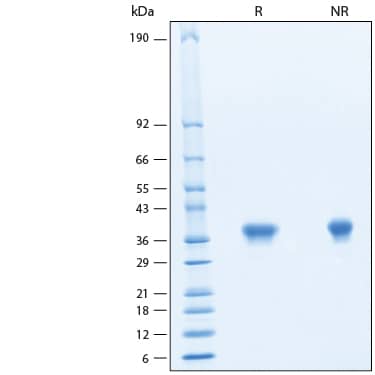 2 μg/lane of Recombinant Monkeypox Virus H3L His-tag Protein (Catalog # 11277-MX) was resolved with SDS-PAGE under reducing (R) and non-reducing (NR) conditions and visualized by Coomassie® Blue staining, showing bands at 36-40 kDa.