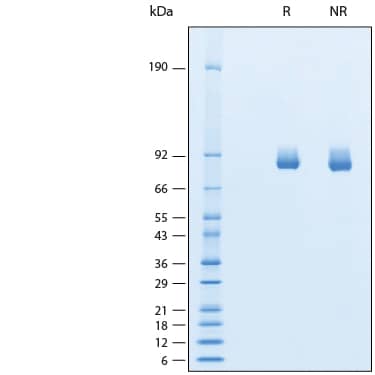 2 μg/lane of Recombinant Cynomolgus alpha-L-Iduronidase/IDUA Protein (Catalog # 11281-GH) was resolved with SDS-PAGE under reducing (R) and non-reducing (NR) conditions and visualized by Coomassie® Blue staining, showing bands at ~81-90 kDa.