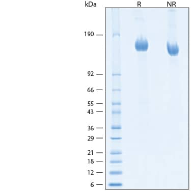 2 μg/lane of Recombinant SARS-CoV-2 BA.4.6 Spike GCN4-IZ His-tag Protein (Catalog # 11286-CV) was resolved with SDS-PAGE under reducing (R) and non-reducing (NR) conditions and visualized by Coomassie® Blue staining, showing bands at 144-160 kDa.