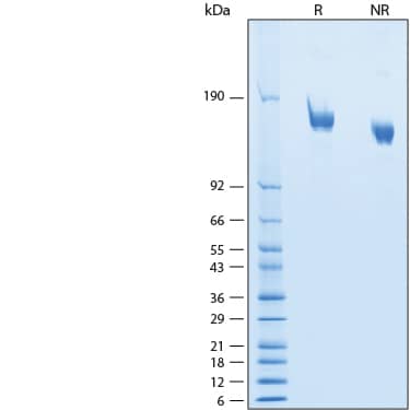 2 μg/lane of Recombinant SARS-CoV-2 BA.2.12.1 S GCN4-IZ His-tag Protein (Catalog # 11287-CV) was resolved with SDS-PAGE under reducing (R) and non-reducing (NR) conditions and visualized by Coomassie® Blue staining, showing bands at 145-165 kDa.
