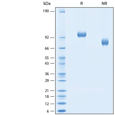 2 μg/lane of Recombinant Human Complement Factor H-related 4/CFHR4 His-tag Protein (Catalog # 11300-CH) was resolved with SDS-PAGE under reducing (R) and non-reducing (NR) conditions and visualized by Coomassie® Blue staining, showing bands at 92-103 kDa.