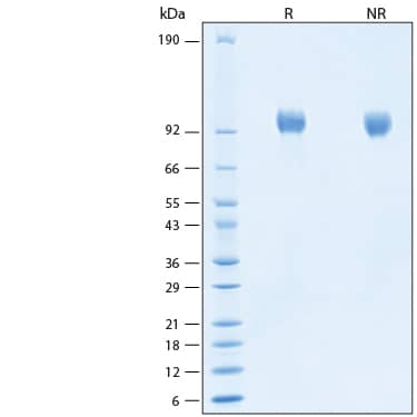 2 μg/lane of Recombinant Human EGFR His-tag Protein (Catalog # 11302-ER) was resolved with SDS-PAGE under reducing (R) and non-reducing (NR) conditions and visualized by Coomassie® Blue staining, showing bands at 94-104 kDa.