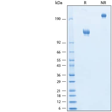 2 μg/lane of Recombinant Cynomolgus Monkey E-Selectin/CD62E Fc Chimera Protein (Catalog # 11308-ES) was resolved with SDS-PAGE under reducing (R) and non-reducing (NR) conditions and visualized by Coomassie® Blue staining, showing bands at 110-132 kDa and 220-260 kDa, respectively.