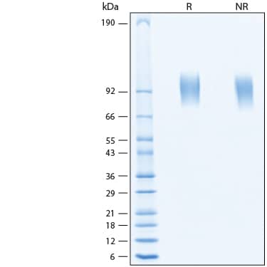 2 μg/lane of Recombinant Mouse Mer His-tag Protein (Catalog # 11313-MR) was resolved with SDS-PAGE under reducing (R) and non-reducing (NR) conditions and visualized by Coomassie® Blue staining, showing bands at 90-102 kDa.