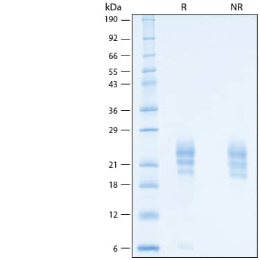 2 μg/lane of Recombinant Human TSLP His-tag Protein (Catalog # 11318-TS) was resolved with SDS-PAGE under reducing (R) and non-reducing (NR) conditions and visualized by Coomassie® Blue staining, showing bands at 19-26 kDa.