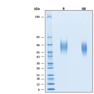 2 μg/lane of Recombinant Cynomolgus Monkey IL-17RA/IL-17R His-tag Protein (Catalog # 11342-IR) was resolved with SDS-PAGE under reducing (R) and non-reducing (NR) conditions and visualized by Coomassie® Blue staining, showing bands at 59-67 kDa.
